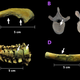 Joint and bone damage found on the skeletal remains: (A) extensive bone wear, (B) signs of hernia on a vertebrae, (C and D) greenish coloration as evidence of a copper bullet.